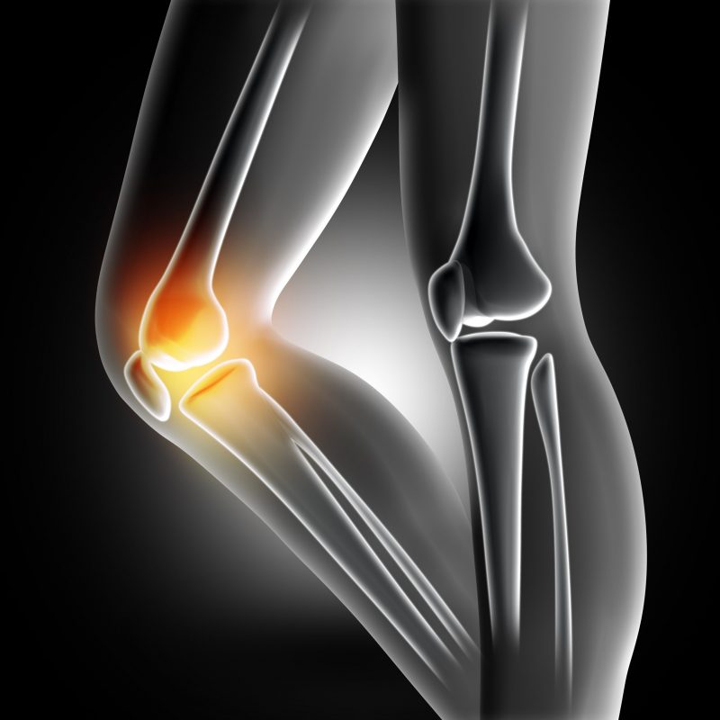 pain-knee-joint-scaled